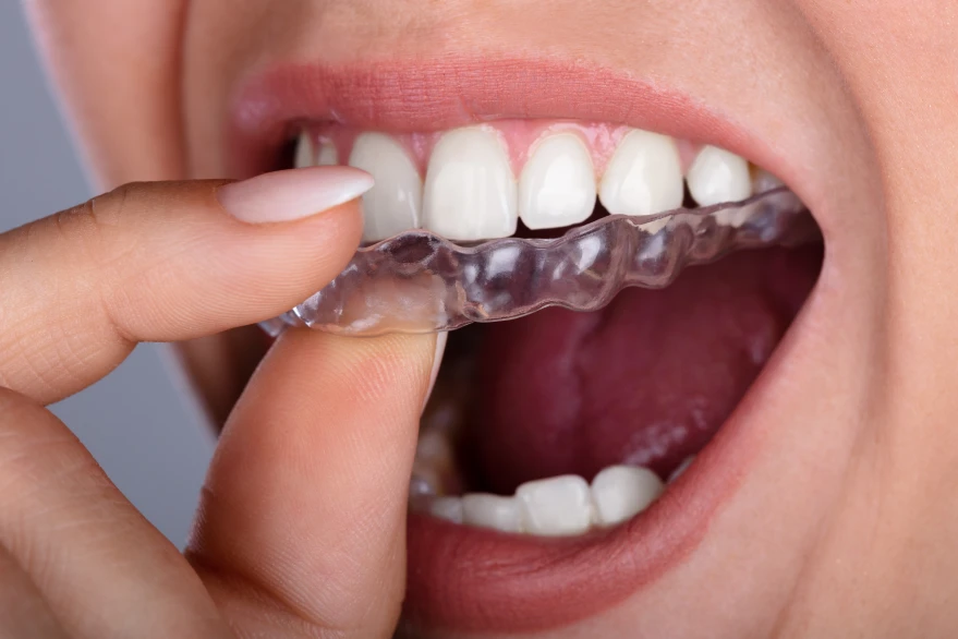 Cosmetic Dentistry, supporting dental care photograph