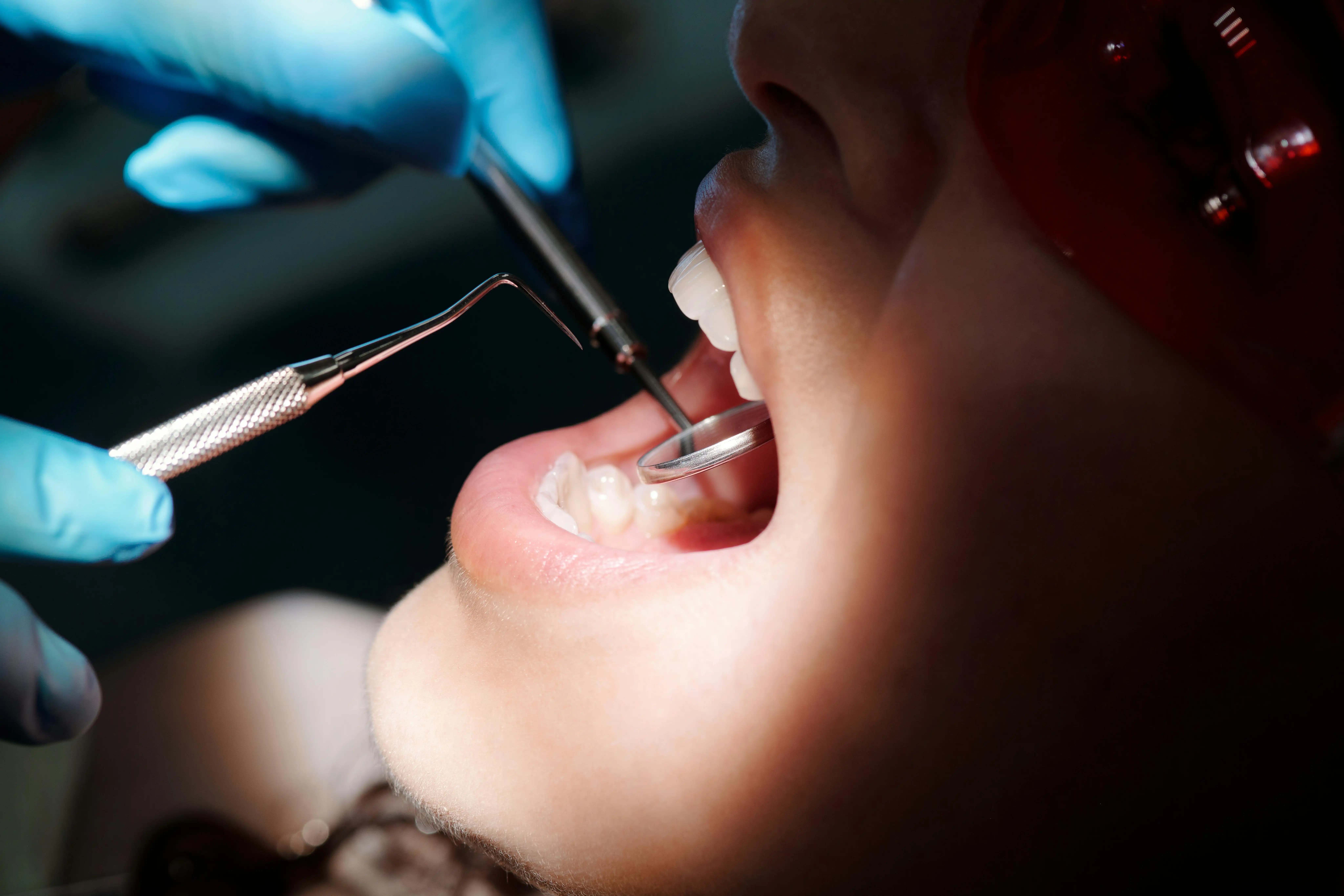 Wisdom Teeth Removal, supporting dental care photograph